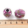 Handmade Indonesia Beads FIND-Q106-03B-3